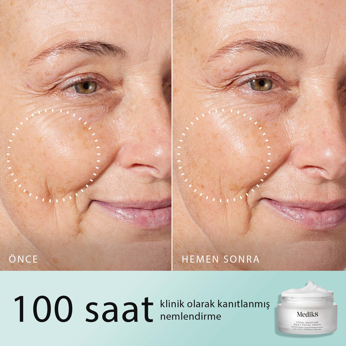 Total Moisture Daily Facial Cream™