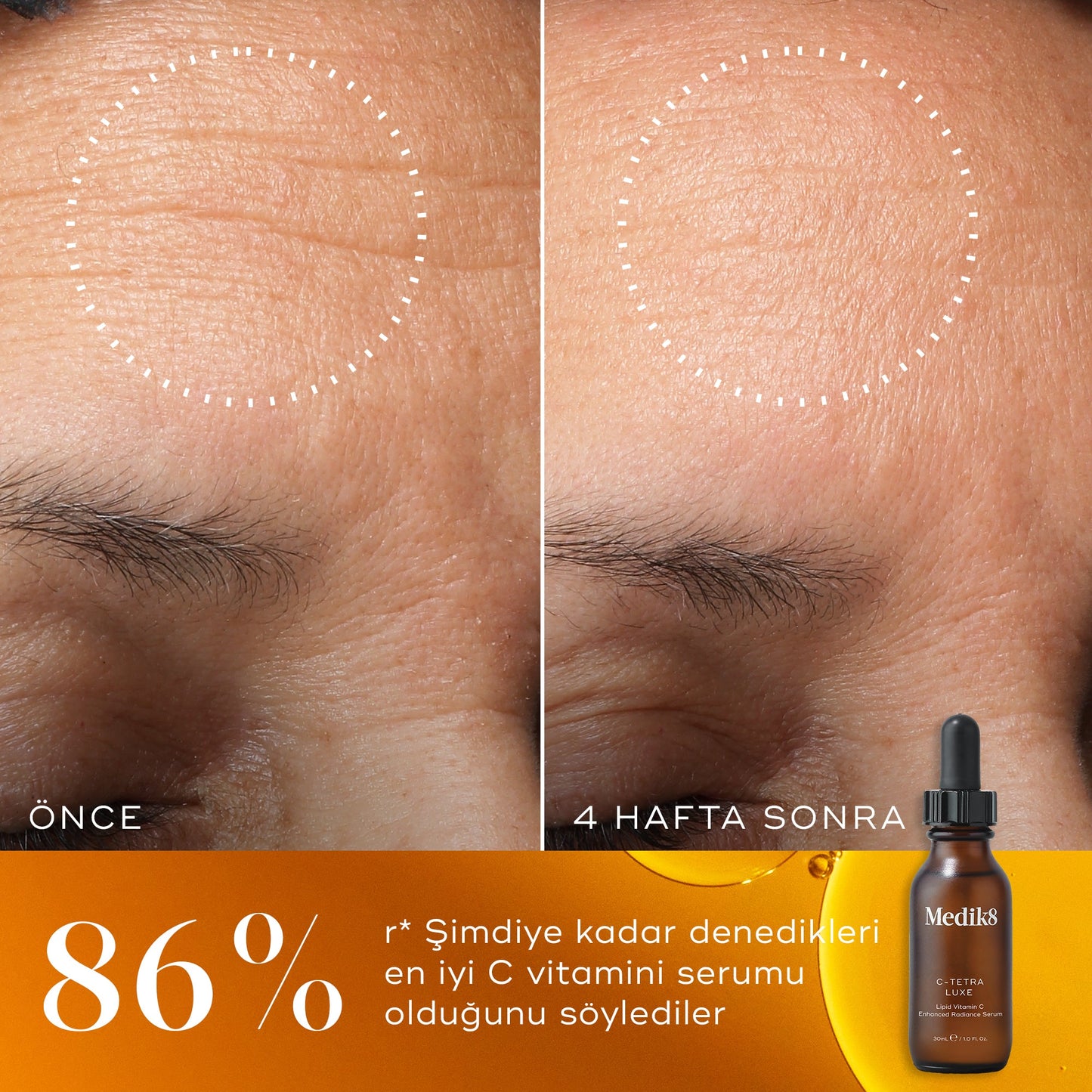 C-Tetra® Luxe (Seyahat Boyu)